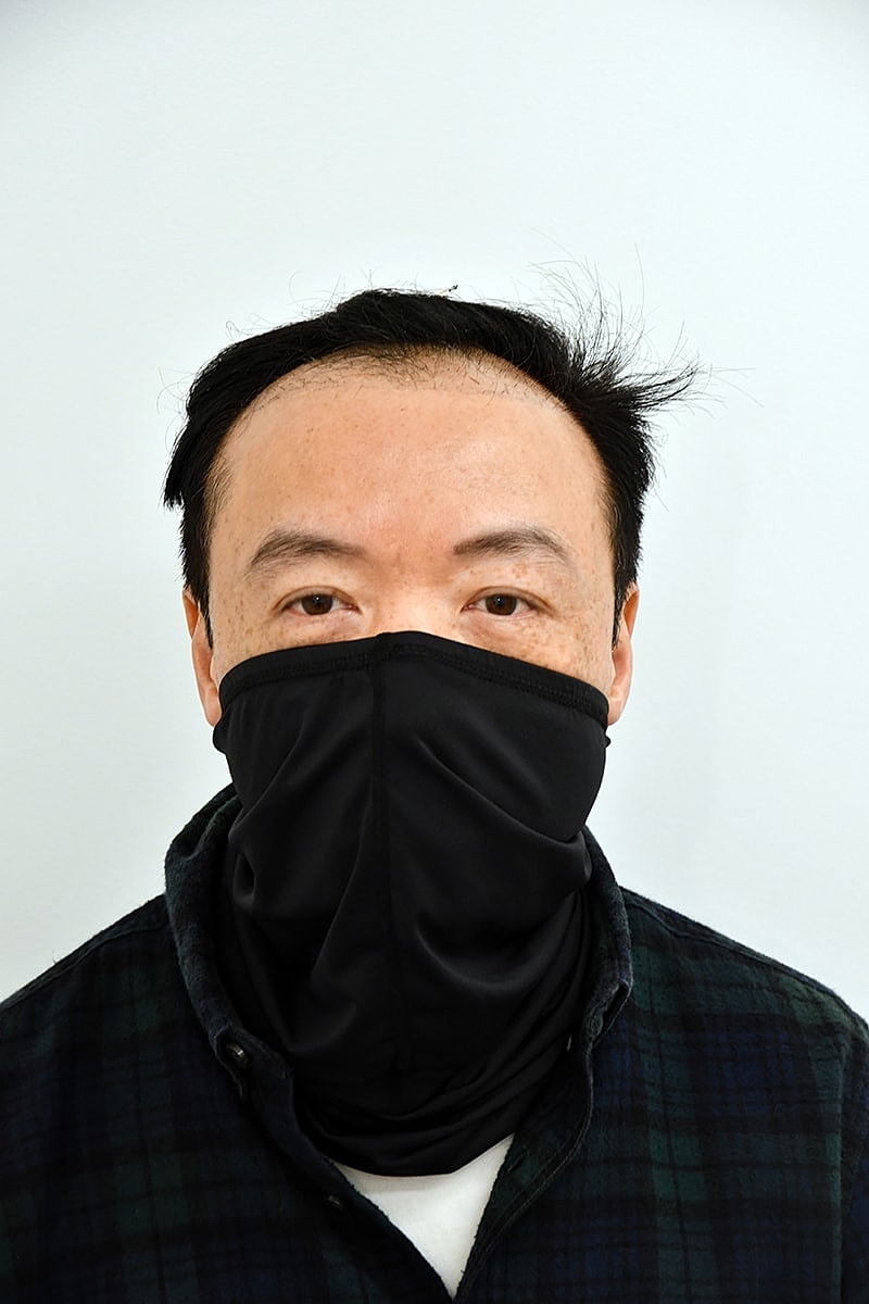 Hair Transplant Before & After