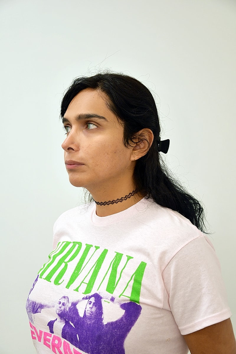 Hair Transplant Before & After