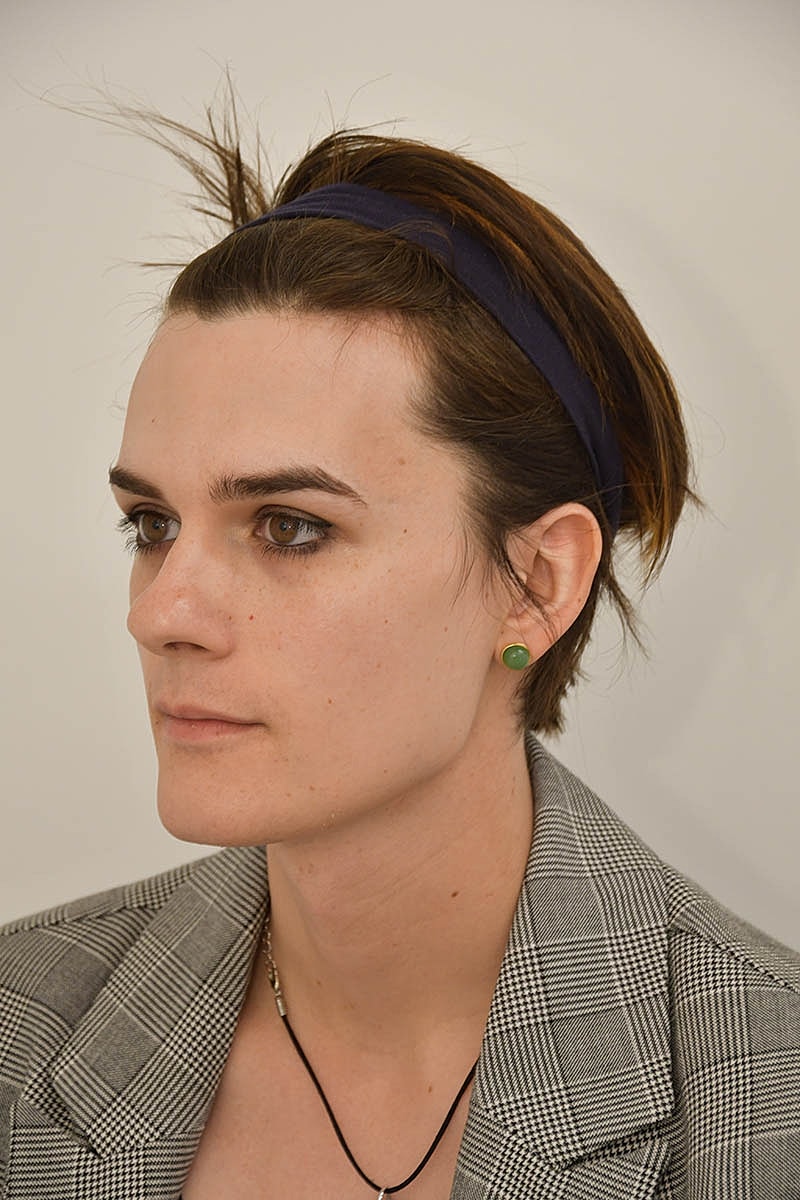 Hair Transplant Before & After