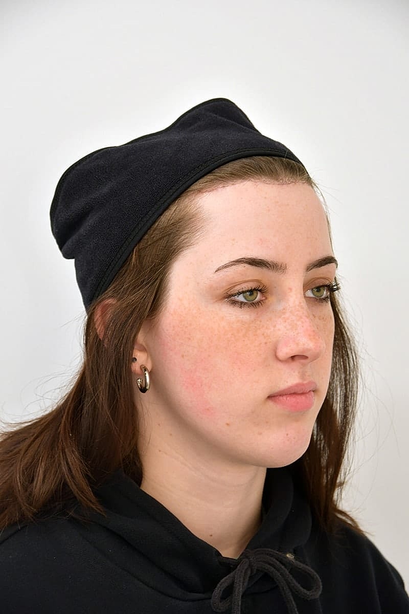 Hairline Lowering Before & After