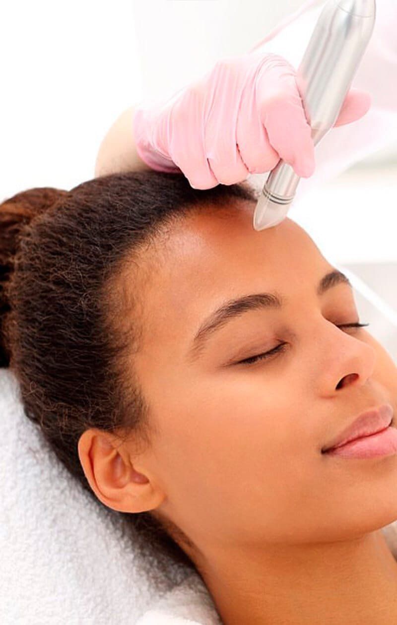 Microneedling in Nairobi