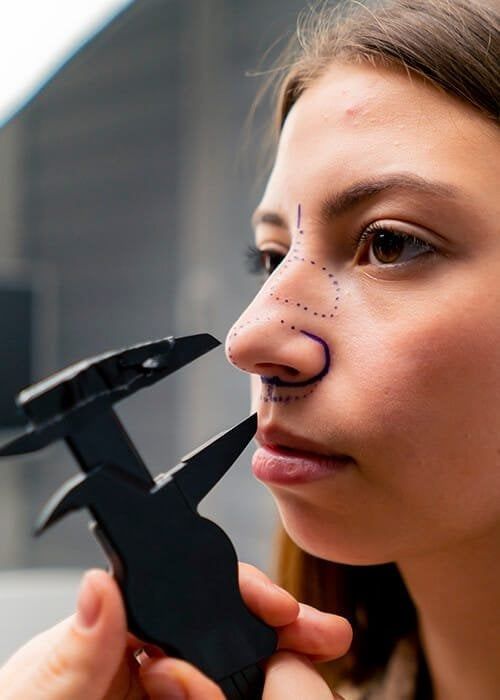 Rhinoplasty Treatment in Nairobi